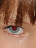 Výřez (R) | © Petr Koritina Výřez (R)