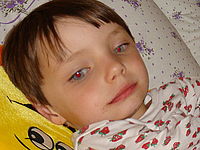 Po úpravě | © Petr Koritina Po úpravě